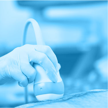 Ultrazvučna dijagnostika